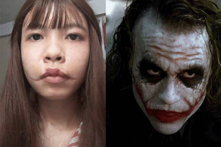 Cô gái sở hữu gương mặt như Joker sau tai nạn thang máy cầu cứu